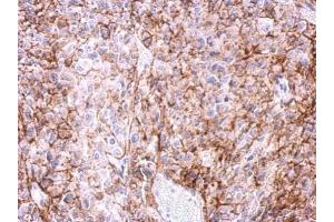 IHC-P Image Immunohistochemical analysis of paraffin-embedded Ca922 xenograft, using Adenosine A2a Receptor, antibody at 1:500 dilution. (Adenosine A2a Receptor antibody  (C-Term))