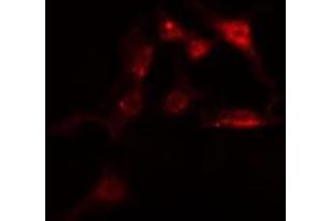 ABIN6275142 staining  HeLa cells by IF/ICC. (IFI16 antibody  (C-Term))