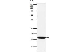 Western blot analysis of NM23A expression in Jurkat cell lysate. (Recombinant NME1 antibody)
