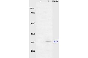 Lane 1: mouse embryo lysates Lane 2: mouse brain lysates probed with Anti RASSF3 Polyclonal Antibody, Unconjugated (ABIN762101) at 1:200 in 4 °C. (RASSF3 antibody  (AA 51-150))