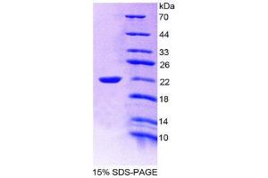 SDS-PAGE (SDS) image for Interleukin 19 (IL19) (AA 25-177) protein (His tag) (ABIN2125470) (IL-19 Protein (AA 25-177) (His tag))