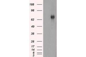 HEK293T cells were transfected with the pCMV6-ENTRY control (Left lane) or pCMV6-ENTRY BTK (Right lane) cDNA for 48 hrs and lysed. (BTK antibody)