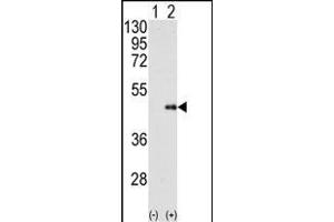 Western blot analysis of FNTB (arrow) using FNTB Antibody (N-term) (ABIN389047 and ABIN2839256). (FNTB antibody  (N-Term))