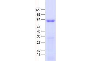 Validation with Western Blot (ZNF597 Protein (His tag))