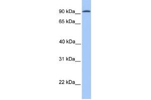 WB Suggested Anti-CDH16 Antibody Titration:  0. (Cadherin-16 antibody  (N-Term))