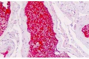 Human Colon, Vessel Plasma: Formalin-Fixed, Paraffin-Embedded (FFPE) (SERPINA1 antibody)