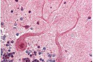 Human Brain, Cerebellum (formalin-fixed, paraffin-embedded) stained with SKP1 antibody ABIN218526 at 1:500 followed by biotinylated goat anti-rabbit IgG secondary antibody ABIN481713, alkaline phosphatase-streptavidin and chromogen. (SKP1 antibody  (C-Term))