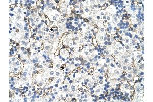 SLC39A5 antibody was used for immunohistochemistry at a concentration of 4-8 ug/ml to stain Hepatocytes (arrows) in Human Liver. (SLC39A5 antibody)