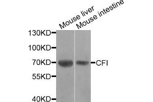 Western blot analysis of extracts of various cell lines, using CFI antibody. (Complement Factor I antibody)