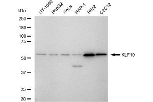 Western blotting analysis using KLF10 antibody (ABIN7799215).