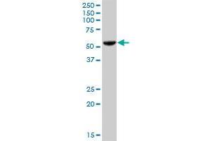 PHGDH MaxPab polyclonal antibody. (PHGDH antibody  (AA 1-533))