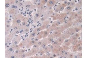 Detection of CRABP2 in Human Liver Tissue using Polyclonal Antibody to Cellular Retinoic Acid Binding Protein 2 (CRABP2) (CRABP2 antibody  (AA 1-138))