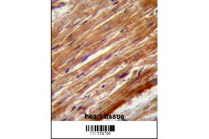 MEKK4 Antibody (Center C1081) immunohistochemistry analysis in formalin fixed and paraffin embedded human heart tissue followed by peroxidase conjugation of the secondary antibody and DAB staining. (MAP3K4 antibody  (AA 1067-1097))