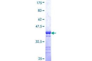 GSC Protein (AA 151-257) (GST tag)