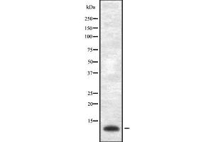 Western blot analysis of VAMP-1/2/3 using Jurkat whole cell lysates (Vamp-1+2+3 antibody)