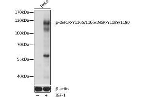 Western blot analysis of extracts of HeLa cells, using Phospho-IGF1R-Y1165/1166/INSR-Y1189/1190 pAb (ABIN7267900) at 1:1000 dilution. (IGF1R antibody  (pTyr1165, pTyr1166, pTyr1189, pTyr1190))