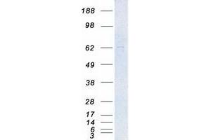 Validation with Western Blot (PAK4 Protein (Transcript Variant 1) (Myc-DYKDDDDK Tag))