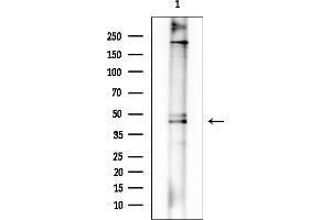 Western blot analysis of lysates from EC304 cells, using RIC3 Mouse Monoclonal Antibody at 1/1000 dilution.