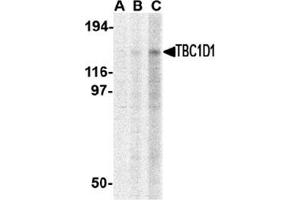 Western blot analysis of TBC1D1 in Daudi cell lysate with this product at (A) 1, (B) 2 and (C) 4 μg/ml.