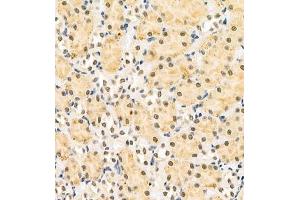 Immunohistochemistry of paraffin embedded rat kidney using HOXC9 (ABIN7074251) at dilution of 1:700 (400x lens) (HOXC9 antibody)