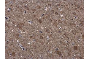 Immunohistochemistry (IHC) image for anti-Ribosomal Protein S3 (RPS3) antibody (ABIN2855736)