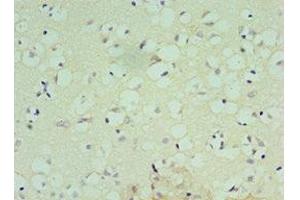 Immunohistochemistry of paraffin-embedded human brain tissue using ABIN7148809 at dilution of 1:100 (ATF7 antibody  (AA 1-117))