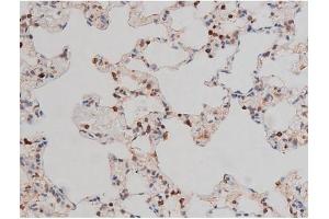 ABIN6267437 at 1/200 staining Rat lung tissue sections by IHC-P. (RPS6KB1 antibody  (pThr229))