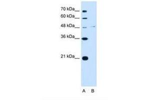 Image no. 1 for anti-Olfactomedin 4 (OLFM4) (C-Term) antibody (ABIN321838) (Olfactomedin 4 antibody  (C-Term))