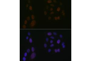 Immunofluorescence analysis of U-2 OS cells using  Rabbit mAb (ABIN3016894, ABIN3016895, ABIN3016896, ABIN1679361 and ABIN1679362) at dilution of 1:100 (40x lens). (ALOX5 antibody)