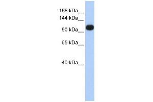 ATP2A3 antibody used at 1 ug/ml to detect target protein. (ATP2A3 antibody  (Middle Region))