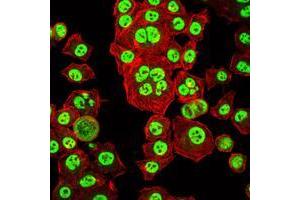 Immunofluorescence (IF) image for anti-Orthodenticle Homeobox 2 (OTX2) antibody (ABIN969332)