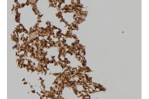 ABIN6259350 and ABIN6275567 at 1/100 staining Mouse lung tissue by IHC-P. (SH3GLB2 antibody  (C-Term))
