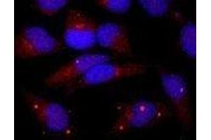 Immunofluorescence (IF) image for anti-Centrin, EF-Hand Protein, 1 (CETN1) (C-Term) antibody (ABIN2451941) (Centrin 1 antibody  (C-Term))