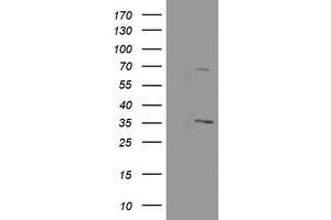 Image no. 2 for anti-Proline Synthetase Co-Transcribed (PROSC) antibody (ABIN1500440) (PROSC antibody)