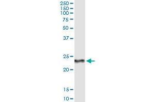Immunoprecipitation of RCVRN transfected lysate using anti-RCVRN monoclonal antibody and Protein A Magnetic Bead , and immunoblotted with RCVRN MaxPab rabbit polyclonal antibody. (Recoverin antibody  (AA 91-181))