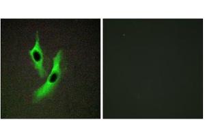 Immunofluorescence analysis of Jurkat cells, using STEAP4 antibody. (STEAP4 antibody  (Internal Region))