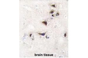 Formalin-fixed and paraffin-embedded human brain tissue reacted with CK2 alpha Antibody (C-term) (ABIN391311 and ABIN2841345) , which was peroxidase-conjugated to the secondary antibody, followed by DAB staining. (CAMK2A antibody  (C-Term))