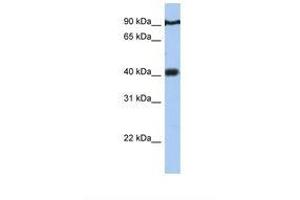 Image no. 1 for anti-Prostate Tumor Overexpressed 1 (PTOV1) (AA 110-159) antibody (ABIN6738729) (PTOV1 antibody  (AA 110-159))