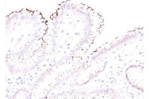 Formalin-fixed, paraffin-embedded human Stomach stained with Helicobacter pylori Rabbit PAb. (Helicobacter Pylori antibody)