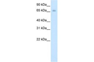 Western Blotting (WB) image for anti-Kelch-like protein 41 (KLHL41) antibody (ABIN2461774) (Kelch-like protein 41 (KLHL41) antibody)