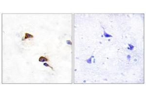 Immunohistochemistry (IHC) image for anti-Peptidylprolyl Isomerase F (PPIF) (Internal Region) antibody (ABIN1849305) (PPIF antibody  (Internal Region))