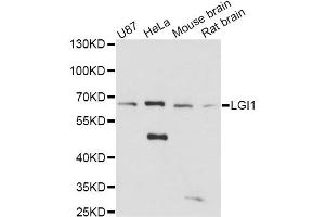 Western blot analysis of extracts of various cell lines, using LGI1 antibody (ABIN1876596) at 1:3000 dilution. (LGI1 antibody)