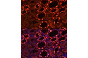 Immunofluorescence analysis of human kidney using V1B1 Rabbit pAb (ABIN6131094, ABIN6137346, ABIN6137347 and ABIN6222603) at dilution of 1:200 (40x lens). (ATP6V1B1 antibody  (AA 1-280))