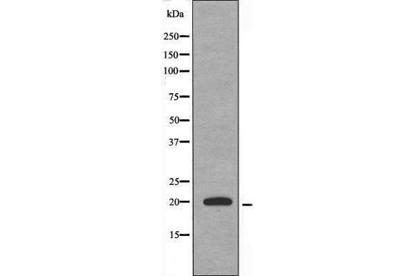 TNFAIP8L2 antibody  (Internal Region)