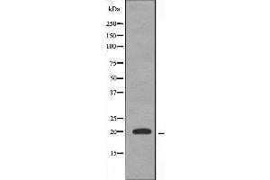 Western blot analysis of extracts from HuvEc cells, using TNFAIP8L2 antibody. (TNFAIP8L2 antibody  (Internal Region))