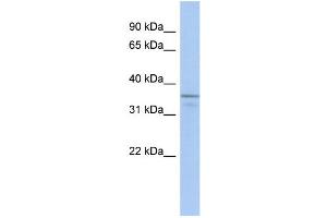 WB Suggested Anti-UBLCP1 Antibody Titration: 0. (UBLCP1 antibody  (N-Term))