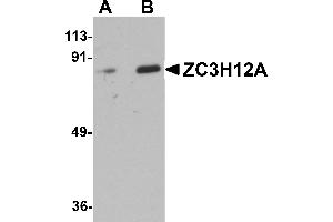 Western blot analysis of ZC3H12A in Raji cell lysate with ZC3H12A antibody at (A) 1 and (B) 2 µg/mL. (ZC3H12A antibody  (Middle Region))