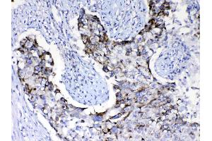 Immunohistochemistry (IHC) image for anti-Phosphoinositide-3-Kinase, Catalytic, beta Polypeptide (PIK3CB) (AA 556-598), (Middle Region) antibody (ABIN5518862)
