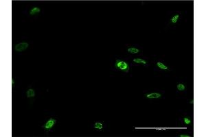 Immunofluorescence of monoclonal antibody to DLX2 on HeLa cell. (DLX2 antibody  (AA 1-124))