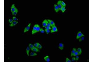 Immunofluorescence staining of HepG2 cells with ABIN7173382 at 1:166, counter-stained with DAPI. (TREM2 antibody  (AA 19-174))